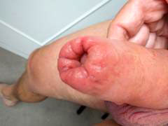 A husband whips his wife every night since she cannot fall asleep without a feeling of pain